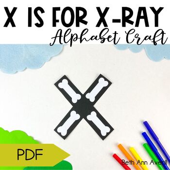 Letter x is for x ray craftivity letter of the week Alphabet Craft